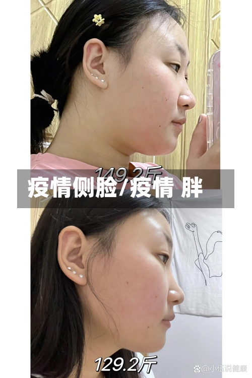 疫情侧脸/疫情 胖-第1张图片